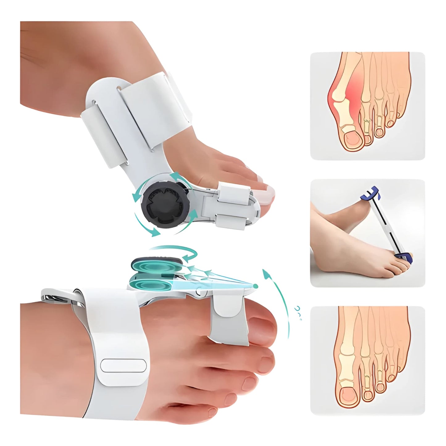 FlexiPie™ Corrector de Juanetes