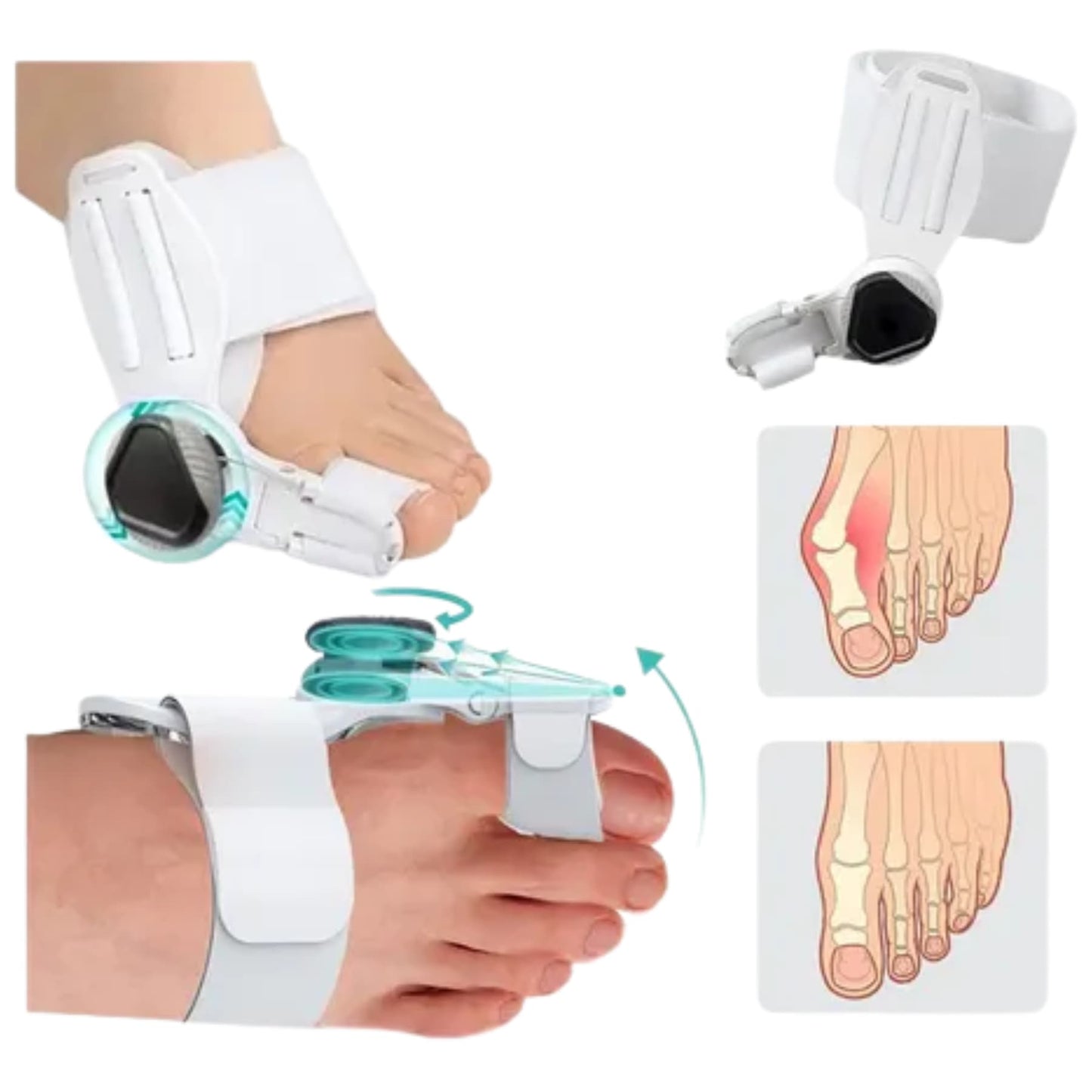 FlexiPie™ Corrector de Juanetes