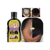 FortiGinger™ - Pack Anticaída